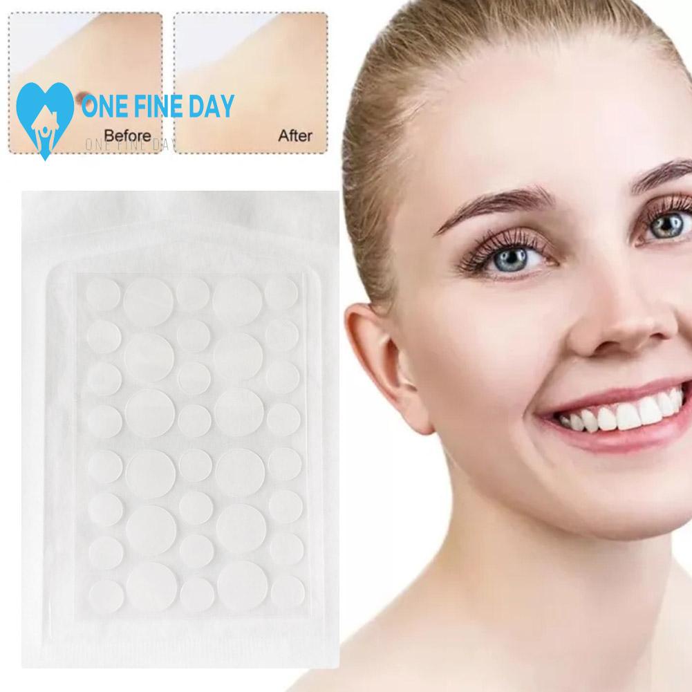 Acne Patch/ Hydrocolloid/Water Gel Invisible Concealer Acne Acne Patch ...