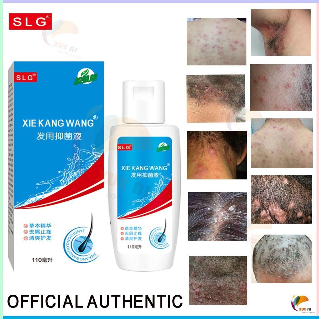 OFFICIAL AUTHENTIC SLG Scalp seborrheic eczema dandruff psoriasis ...