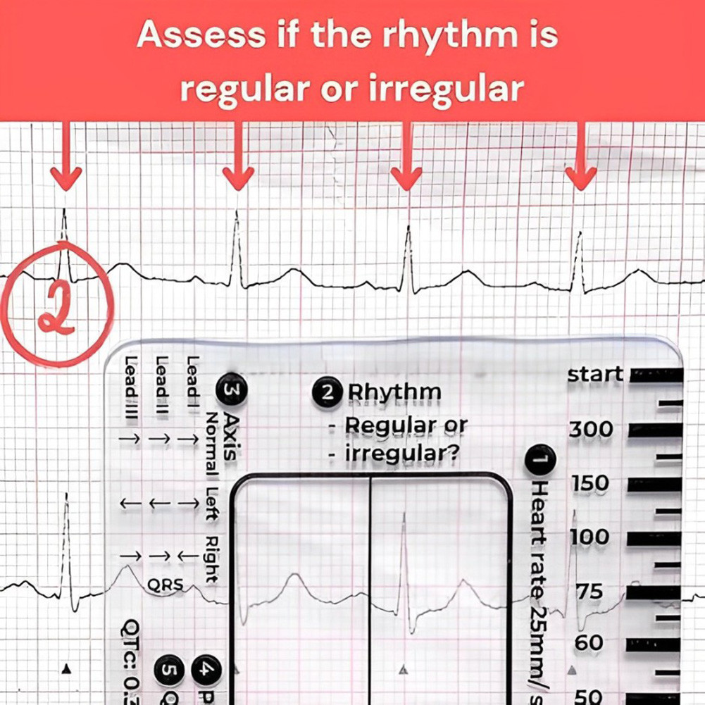 [kristyle.my] ECG 7 Step Ruler Portable Pocket-Sized EKG Measuring Card ...