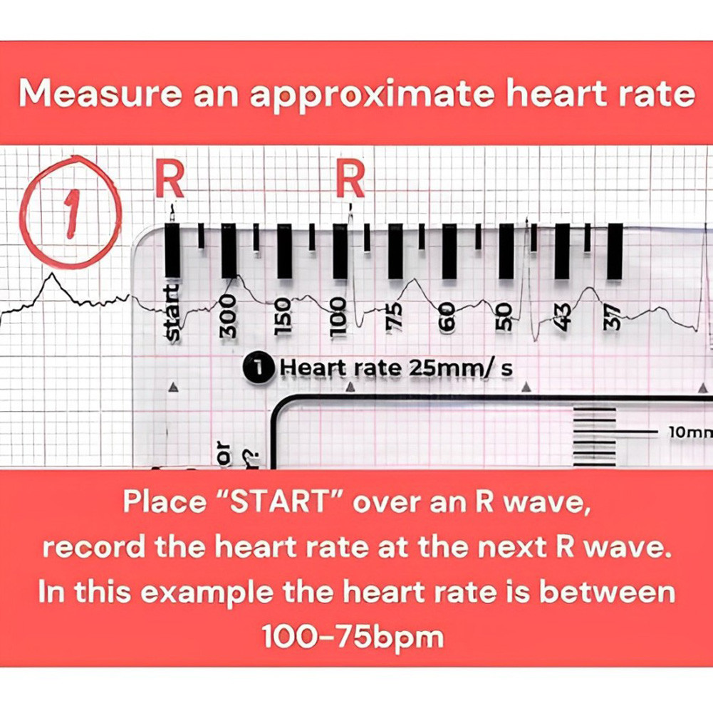 ECG 7 Step Ruler Portable ECG/EKG 7 Step Ruler Card ECG Reference Tool ...