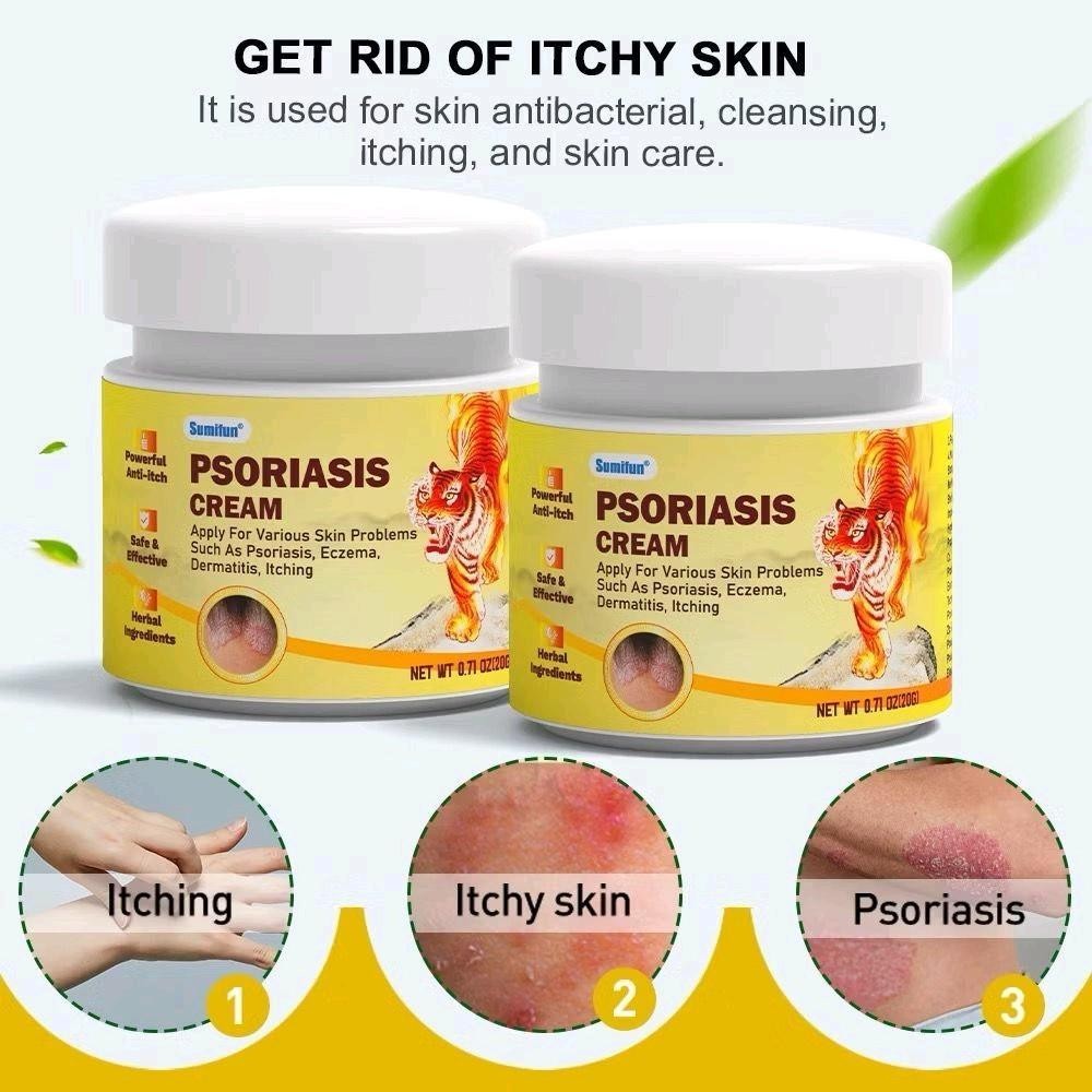 Sumifun Psoriasis Eczema Cream for skin itchy Krim Gatal Kulit Masalah ...