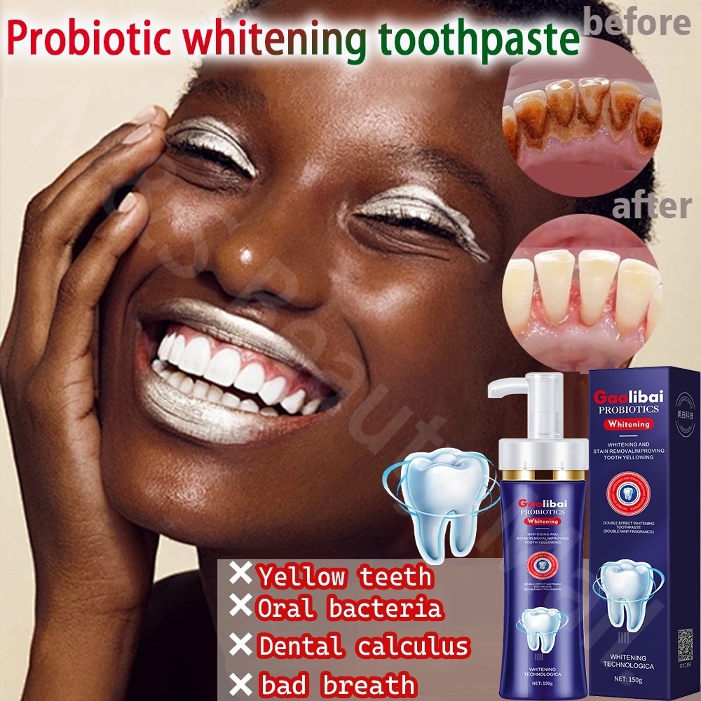 Whitening toothpaste 150g teeth whitening fresh breath remove yellow ...