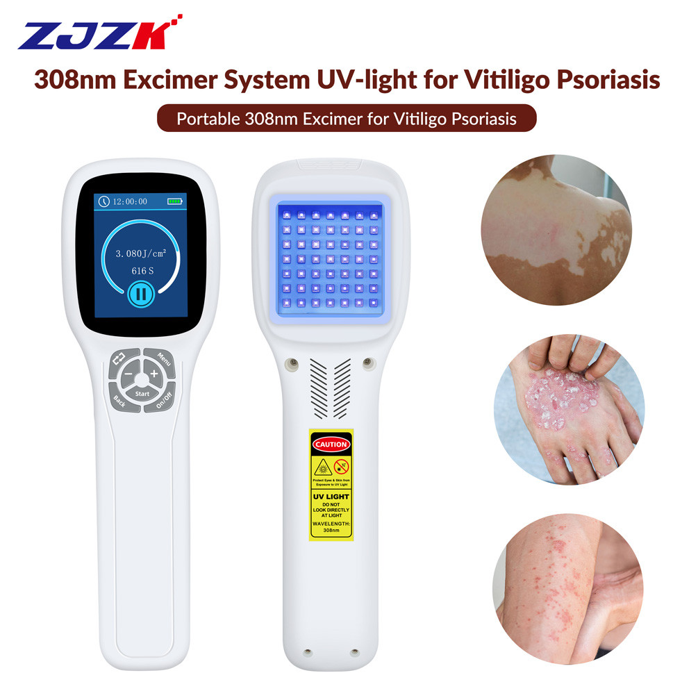 308nm LED UVB Light Therapy Excimer Instrument for Spots Caused by ...
