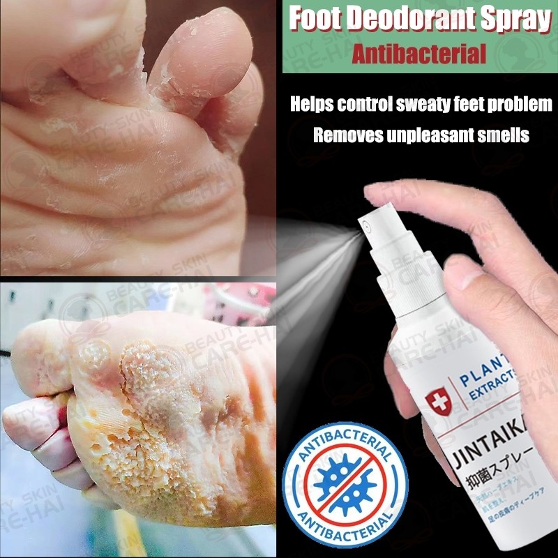 Foot spray Foot deodorant Smelly feet 30ml Foot Odor Eliminator for ...