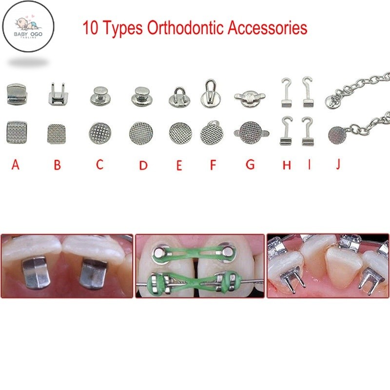 OGO Dental Lingual Button Weldable Bondable Monoblock Traction Cleat ...