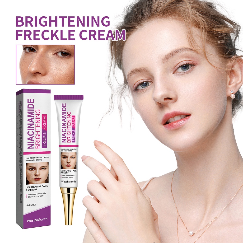 Nicotinamide Whitening Freckles Cream Remove Melasma Dark Spot Acne Marks Lightening Melanin