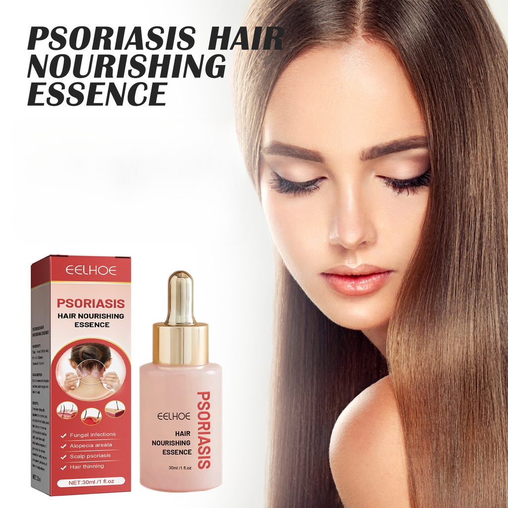 CHIBEL 30ml Psoriasis Scalp Treatment Serum Dandruff Removal Anti Itchy Follicle Repair Oil