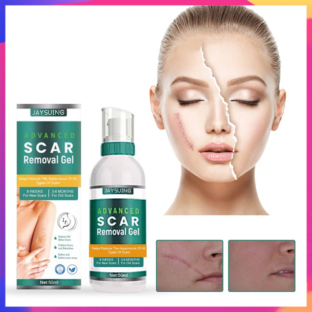 Facial Bump Scar Removal Visible Results Scar Repair Surgical Scar Treatment Advanced Formula