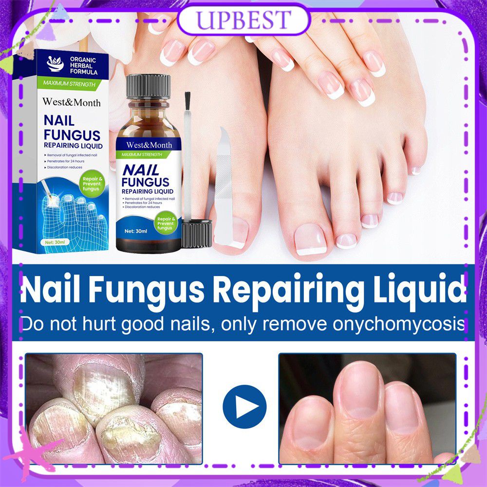 West&month Nail Fungus Repair Liquid Set Repair Onychomycosis