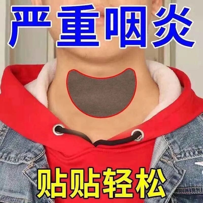 Cough patch咽炎贴严重急慢性咽喉干呕干咳有痰有异物感肿痛滤泡增生Severe pharyngitis patch, acute