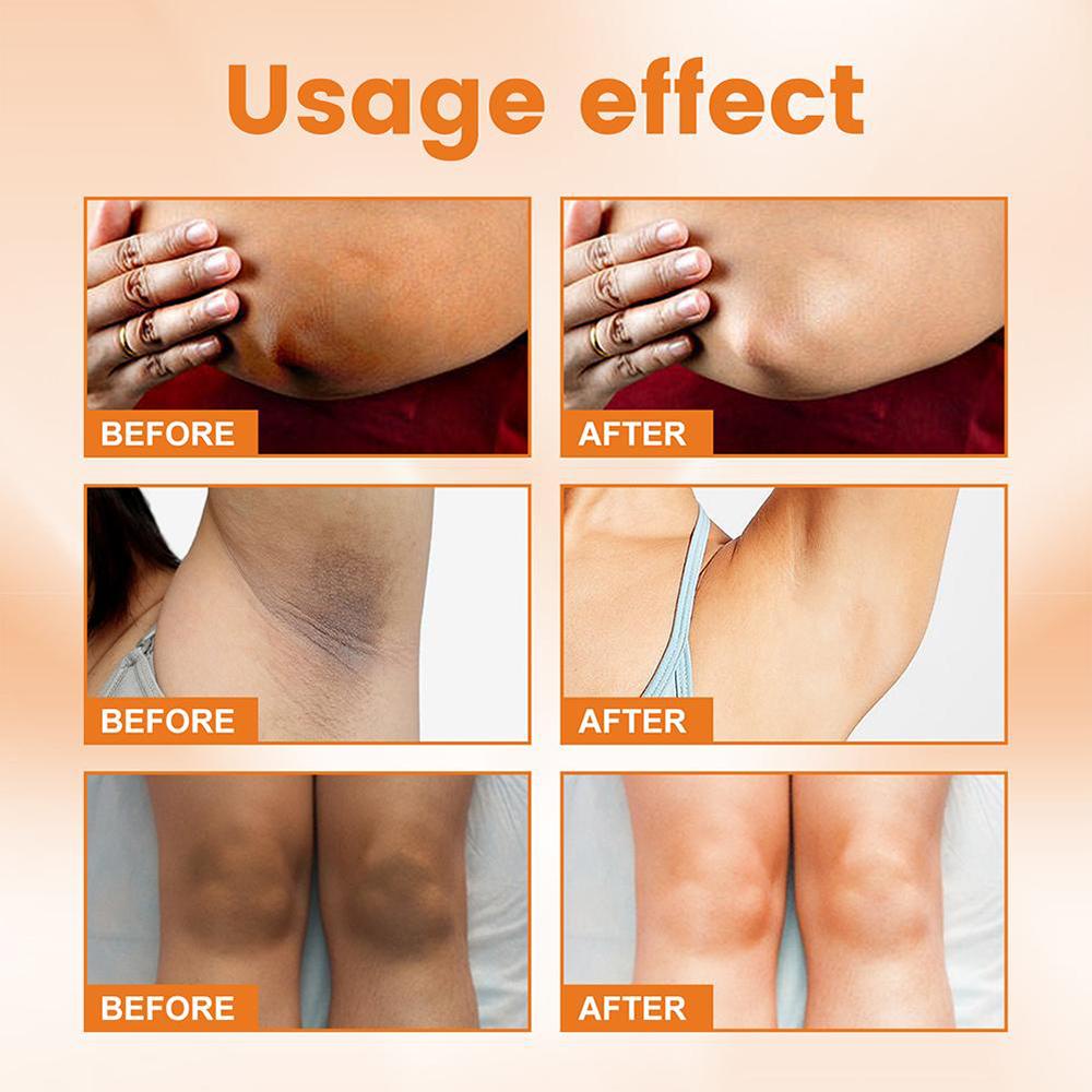 can glutathione whiten underarm 30G COSROS Sakura Whitening Cream Whitening Underarm Cream disposable booties for shoes covers