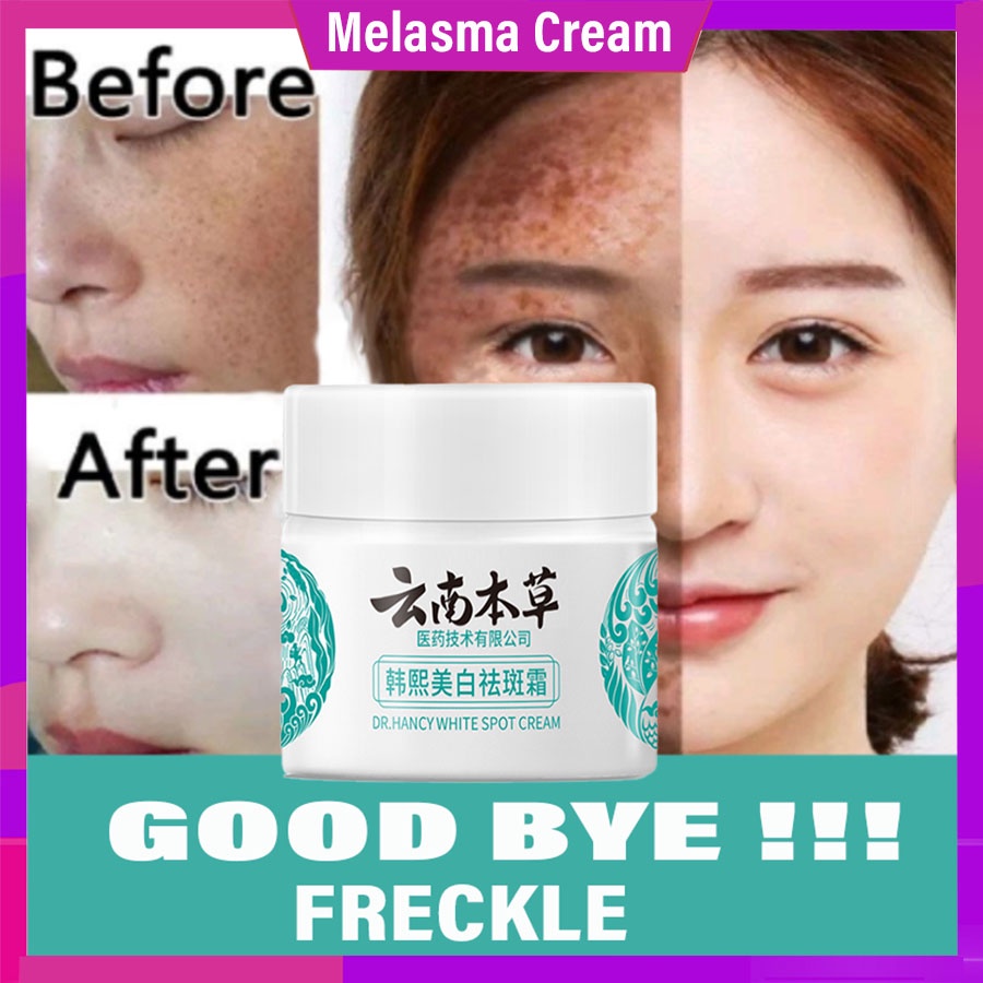 Face Whitening Cream Yunnan Herbal Whitening Freckle Cream Moisturizing