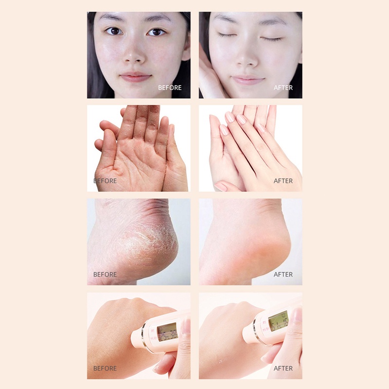 NM11 15g Lanolin Oil AntiDrying Crack Foot Cream Heel Cracked Frost Care Hand Foot Winter Feet