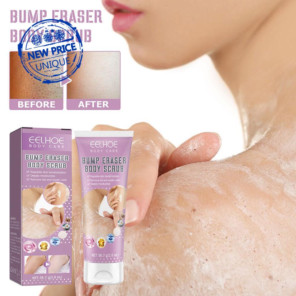 Repair Chicken Skin Cream Keratosis Pilaris Cream For Strawberry Legs Removal Dark Spot KP Bump