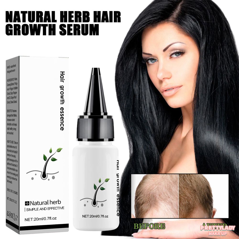 Hair Growth Hair Growth Products 7.9 2.5 2.5cm Anti Hair Loss Treatment