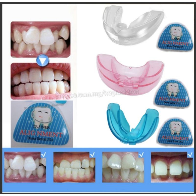 [With CASE] Orthodontic Teeth Trainer | Shopee Malaysia