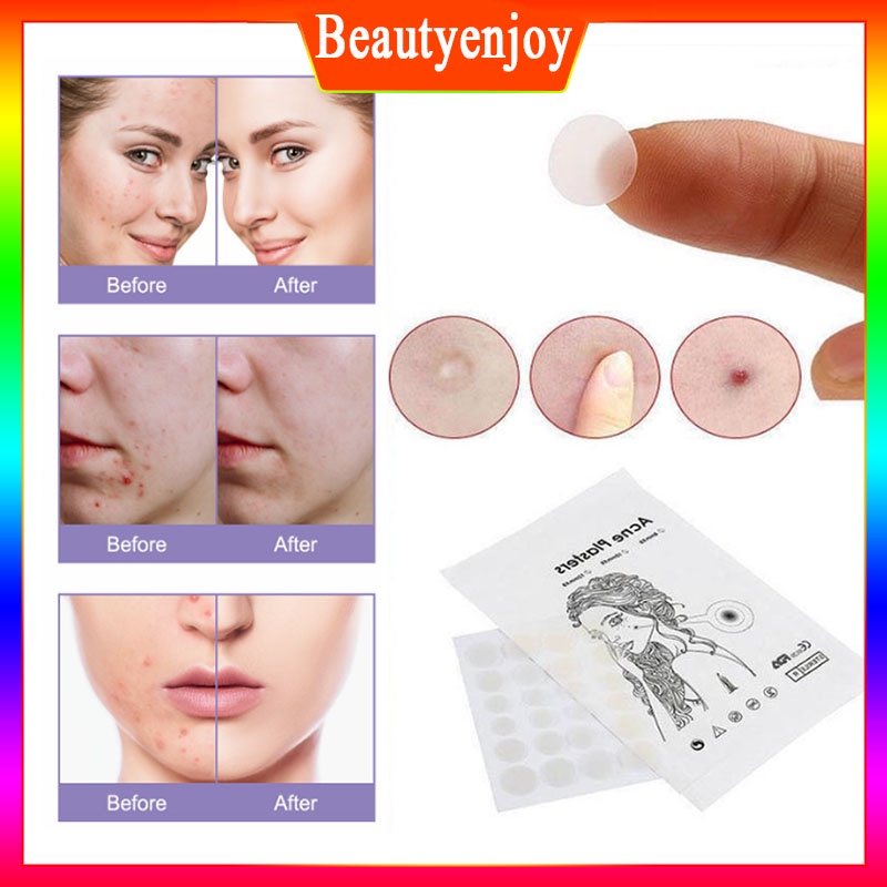 Salicylic Acid 36PCS Invisible Acne Pimple Removal Patch Acne Treatment ...