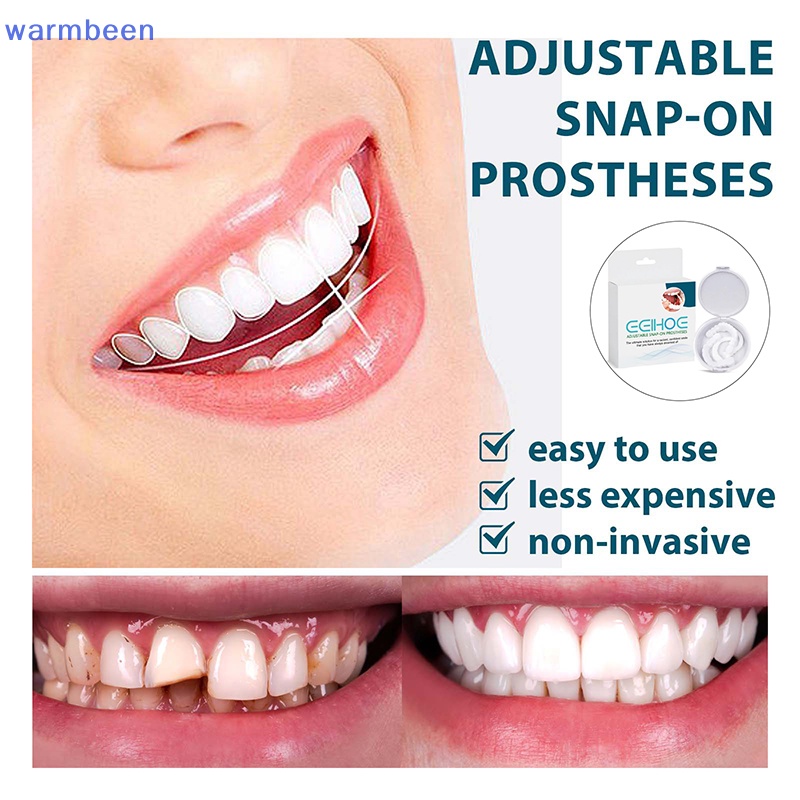 (warmbeen) 1 Pair Fit Teeth Whitening Fake Tooth Cover Snap On Resin
