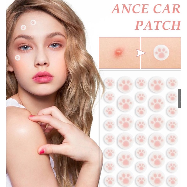 36pcs Cute Cat Paw Acne Removal Pimple Patch Ance Care Patch ...