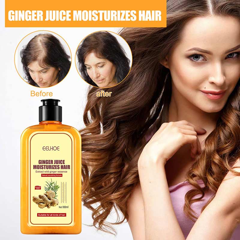 Eelhoe Ginger Anti-Hair Loss Shampoo Moisturizing Repair Hair Follicle ...