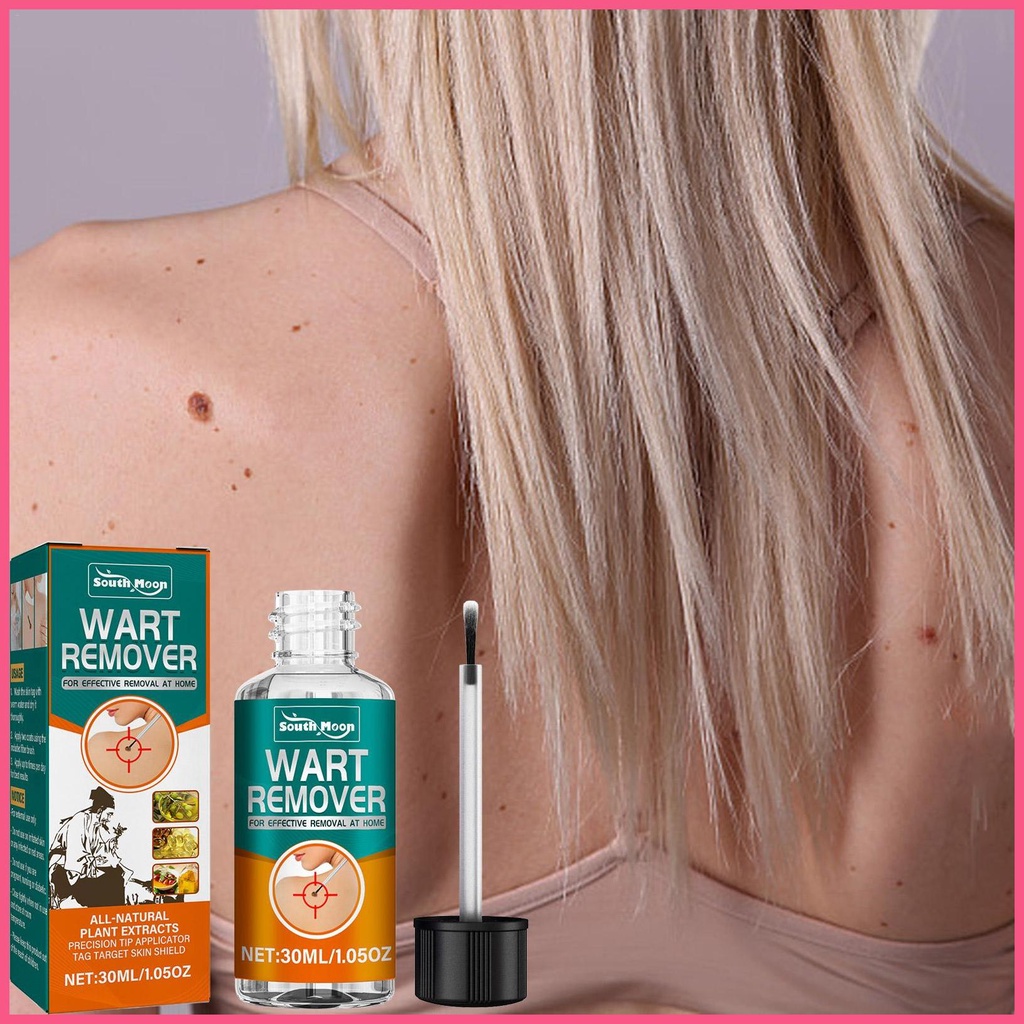 Skin Wart Remover Liquid Against Moles And Genitals Fast Wart Removal On Legs Wart Papilomat 9639