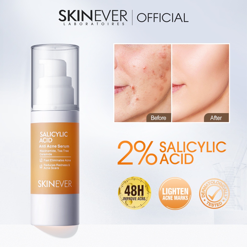 SKINEVER Salicylic Acid Serum Oily Skin Pimple Acne Mark Pimple Remover