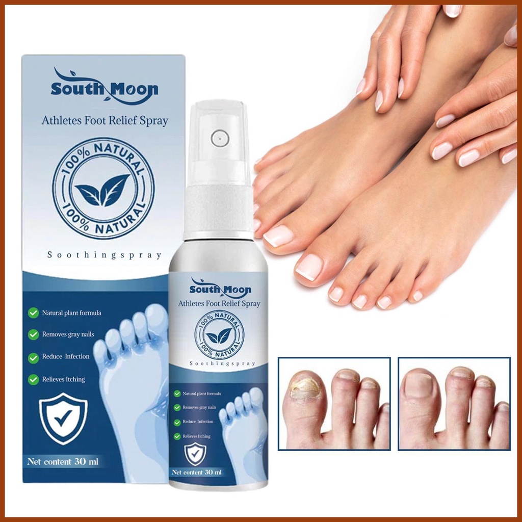 Athletes Foot Treatments Spray Natural Anti-Fungi Relief For Inflamed ...