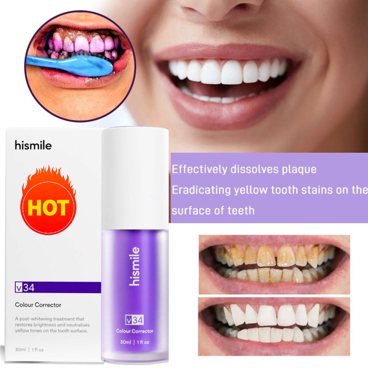 [Ready Stock]Tooth Color Liquid Wireless Charging Kit Electric Wire ...