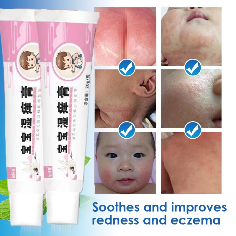 Baby Skin Repair Cream Treatment Kids Diaper Rash Psoriasis Dermatitis ...