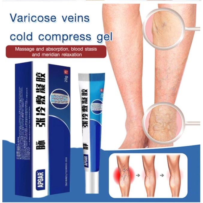 Varicose vein cold compress gel 20G Relieve symptoms such as