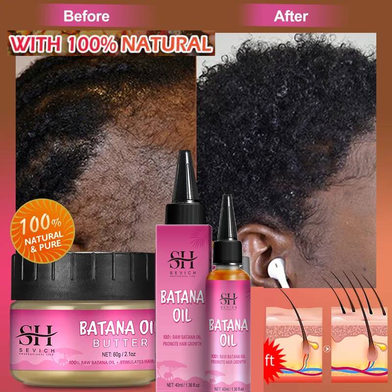 Batana Oil Fast Hair Growth Traction Alopecia Hair Mask Anti Break Loss