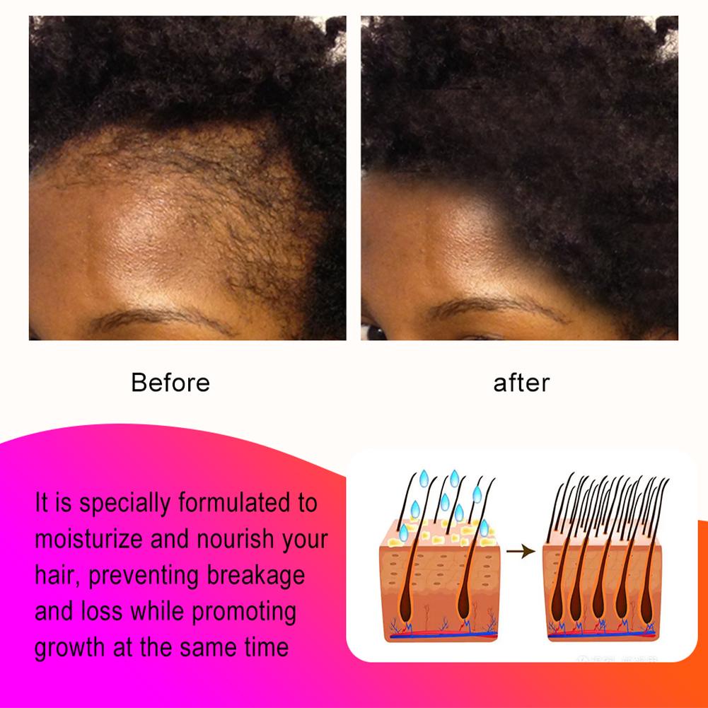 Africa Chad 100% Chebe Powder Women Traction Alopecia Crazy Hair Break ...
