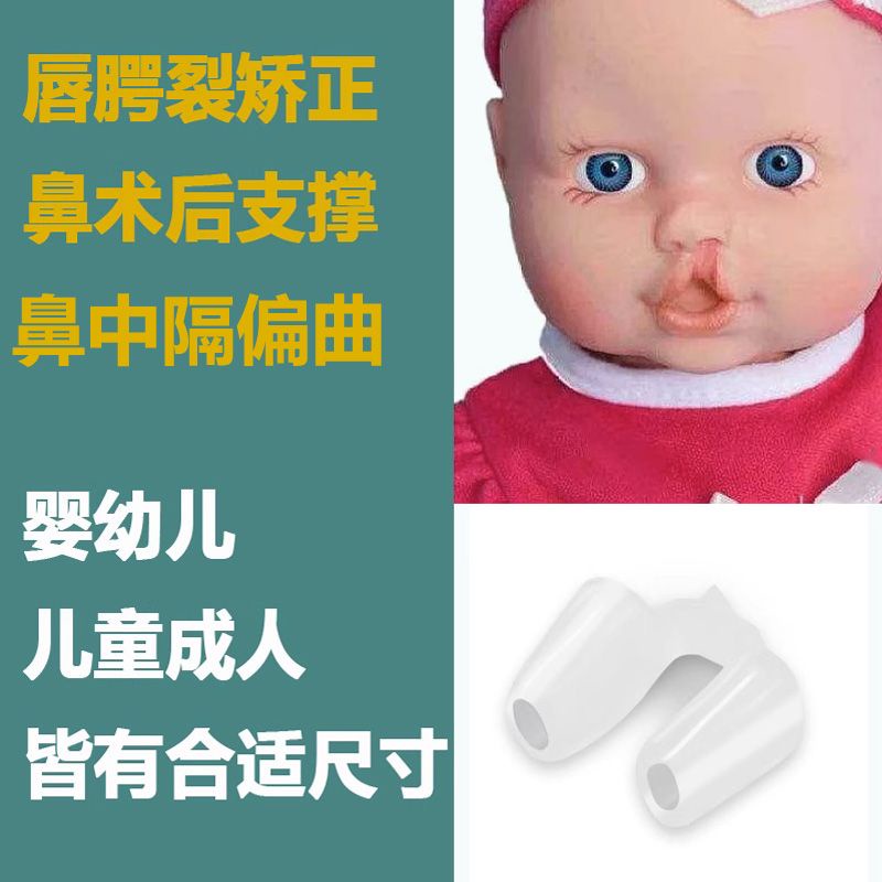 No Nostril supporter after comprehensive rhinoplasty, cleft lip Nose