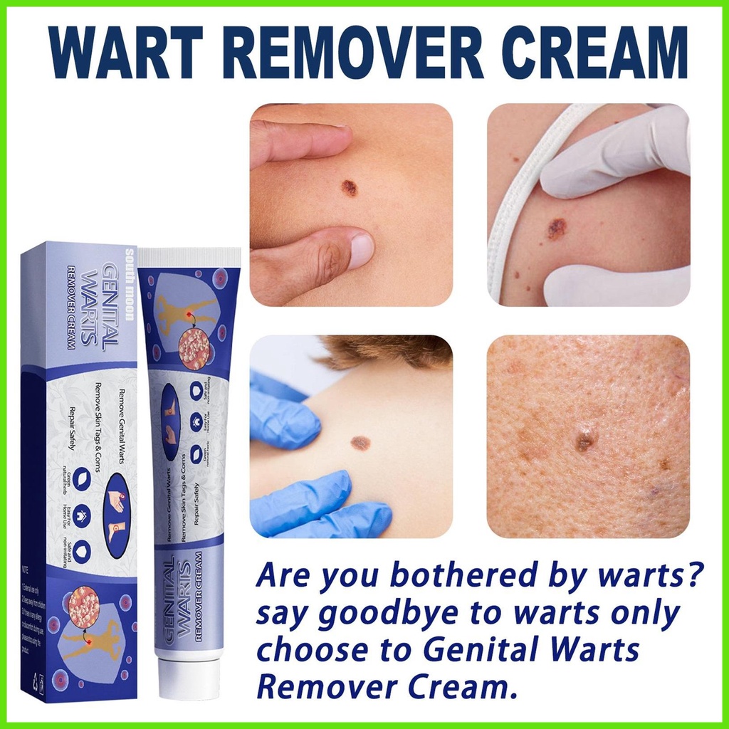 Plantar Wart Remover Itchy Wart Vanishing Salve For All Skin Types