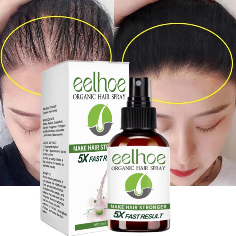 Fast Hair Growth Spray Anti Hair Loss Serum Prevent Baldness Treatment
