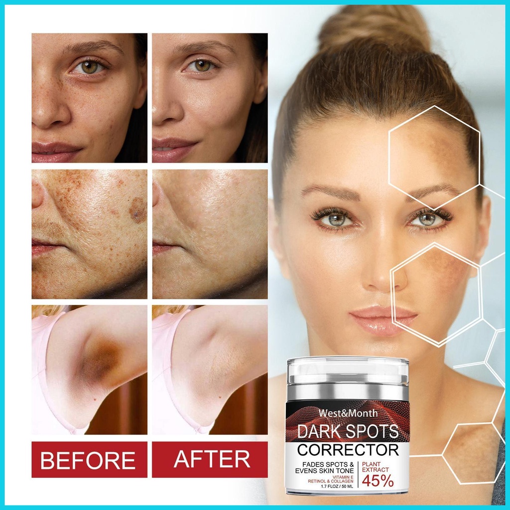 Skin Lightening Cream Skin Lightening Cream for Intimate Areas Pretty