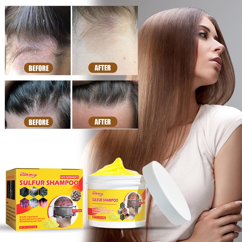 Sulfur Shampoo for Healthy Scalp, Lice & Itch Control, Oil Cleansing