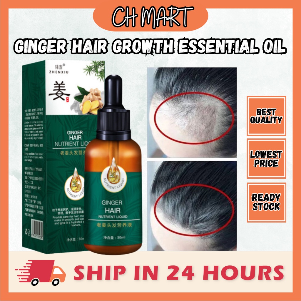 Hair Care Men Women Ginger Hair Growth Essential Oil Ginger King Rambut
