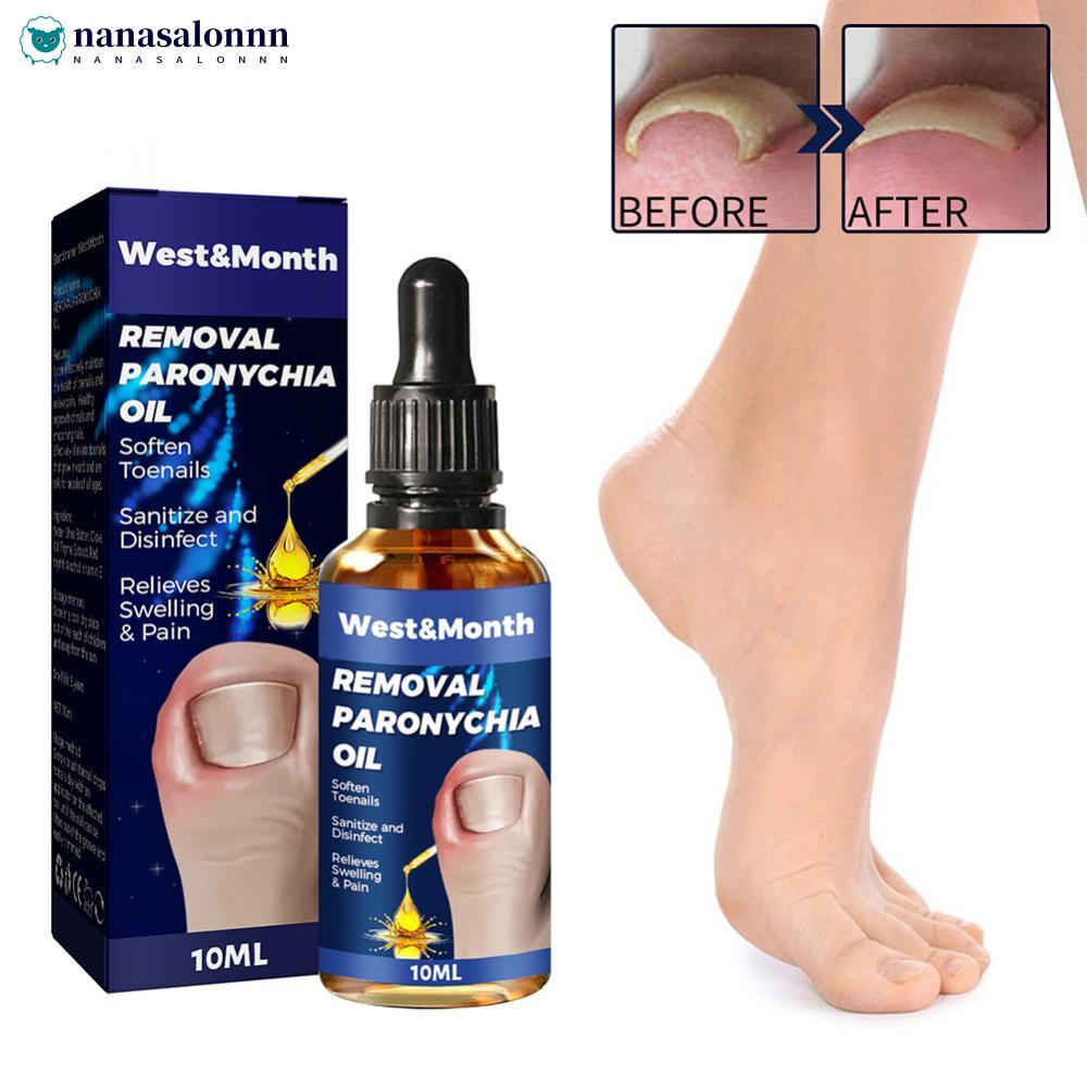 NANASALONNN 10ml Removal Paronychia Oil Soften Toenails Relieve Swelling Pain Nail Groove Relief