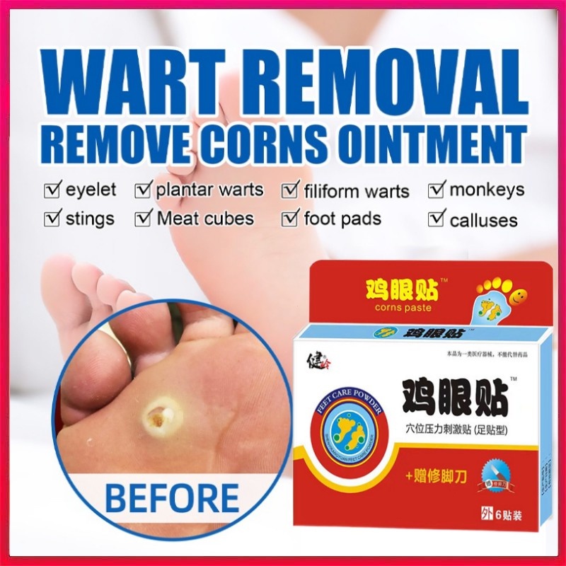 5pcs Foot corn removal patch warts calluses remover corn foot corn caps