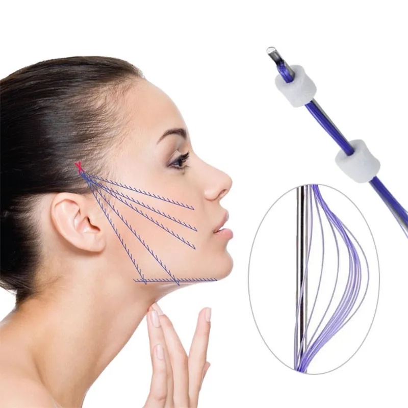 PDO Multi Thread 23g38mm Face Wrinkles Removing 20pcs/pack | Shopee ...