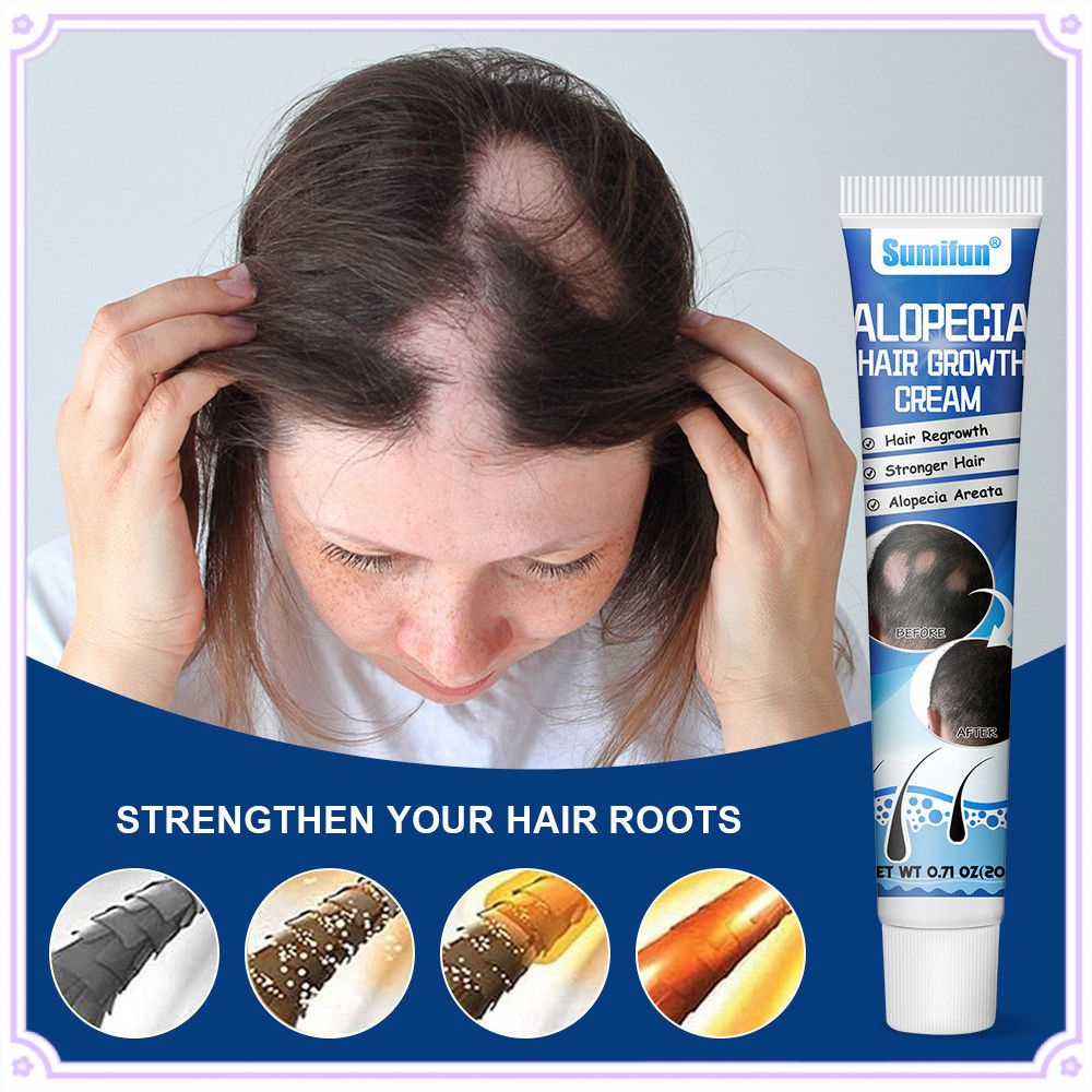 Sumifun Flavescens Alopecia Areata Cream Promote Hair Growth Prevent