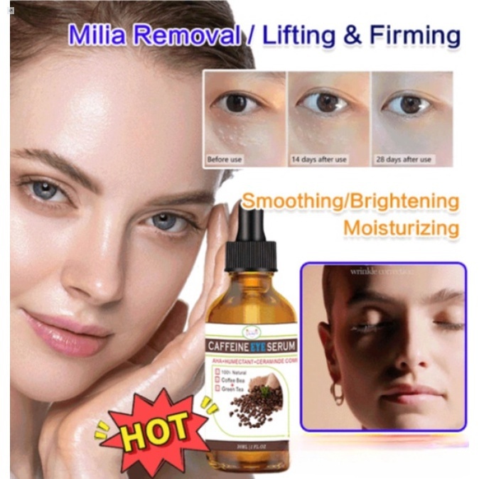 Yunxi Milia Removal Essence Fat Granule Eye Essence Mpfv Shopee Malaysia