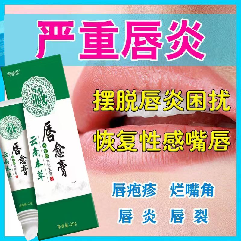 Special lip balm for cheilitis. Frequent licking o唇炎专用唇膏经常舔嘴唇嘴唇干裂脱皮红肿水泡