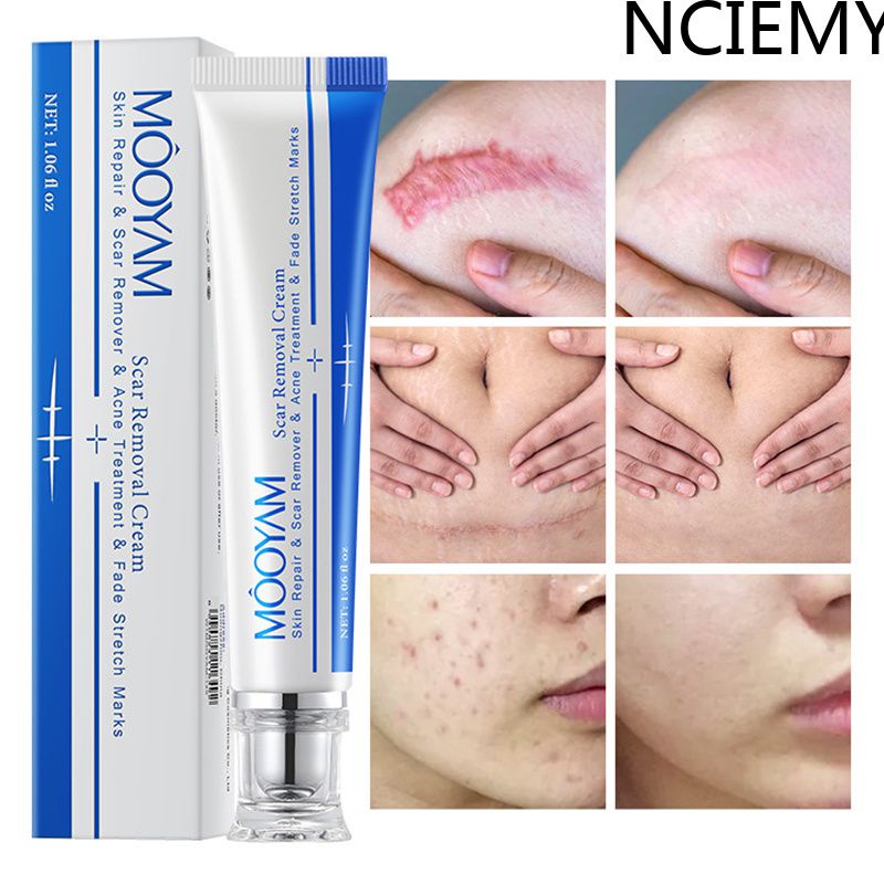 Mooyam Moisturizing Scar Repair Scar Treatment Stretch Marks Chickenpox