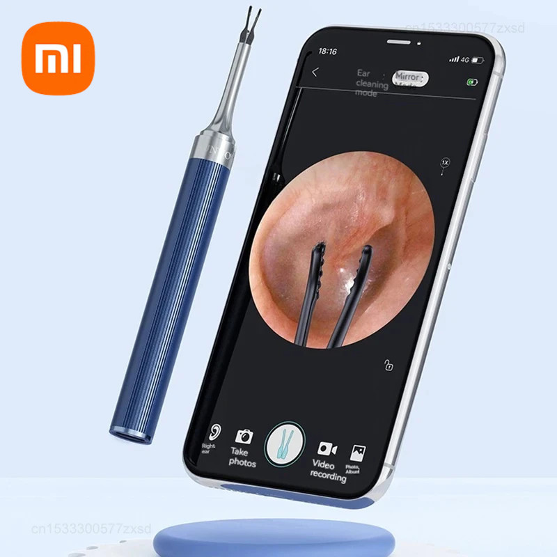 Xiaomi Sunuo Smart Visual Ear Sticks S9 1000W Pixels HD Endoscope ...