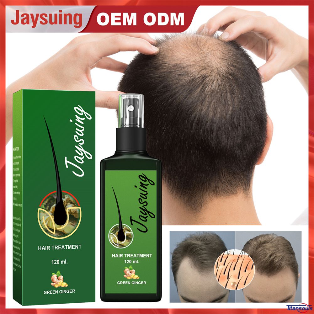 Bestseller Antifall Hair Growth Spray Hair Nourishment Improve Hair