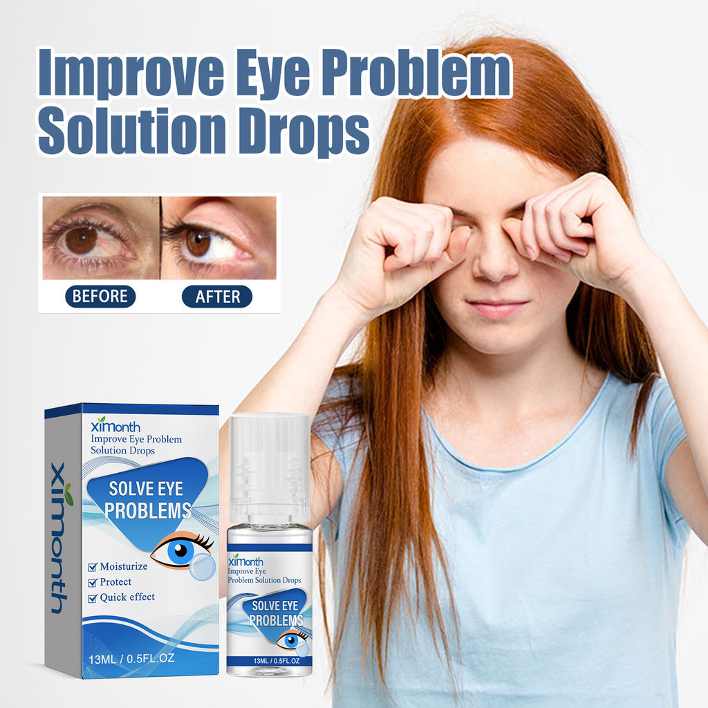 Myopia Eye Drops Relieve Eye Fatigue, Soreness, Redness and Swelling, Blurred Vision, Gentle Eye