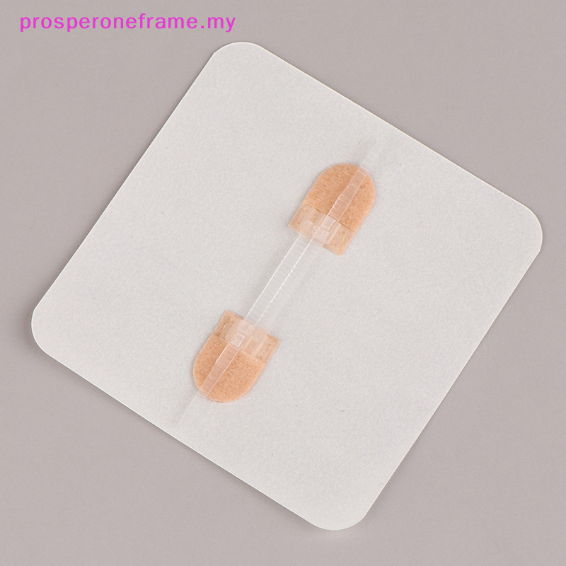 prosperoneframe 1pc Zipper Tie Wound Closure Patch Hemostatic Patch ...