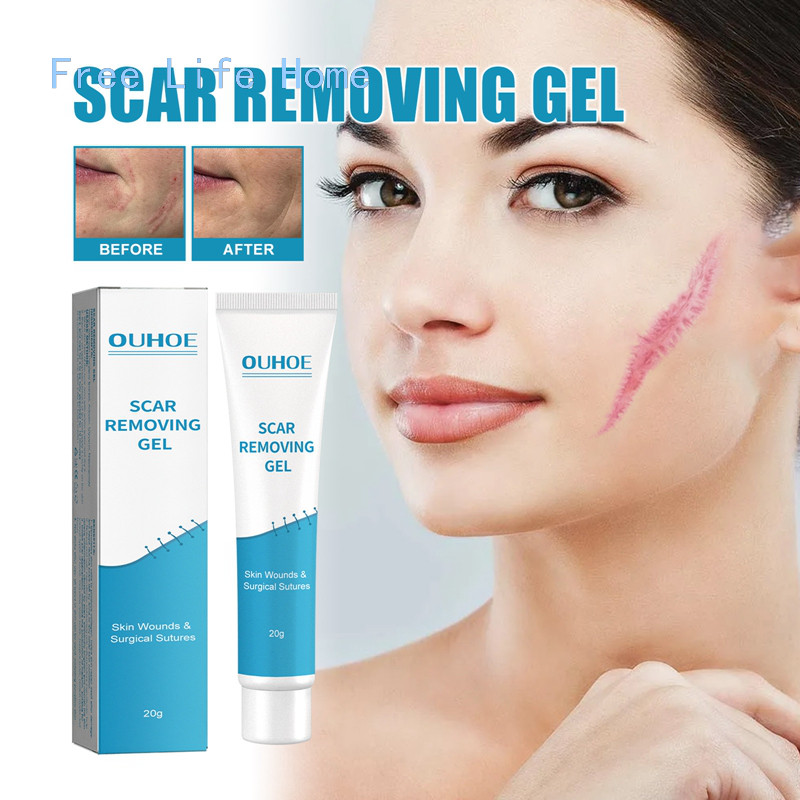 20g Scar Removal Cream Scar Repair Gel Fade Scars Burns Caesarean ...